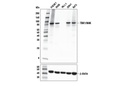 TBK1/NAK (E9H5S) Mouse mAb