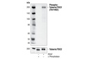 Phospho-Tuberin/TSC2 (Thr1462) (5B12) Rabbit mAb