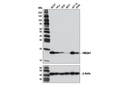 HMGA1 (D6A4) XP Rabbit mAb