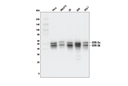 GSK-3α/β (D75D3) Rabbit mAb
