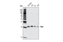 Bad (D24A9) Rabbit mAb