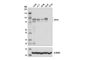 IFI16 (D8B5T) Rabbit mAb