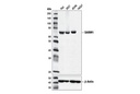 SARM1 (D2M5I) Rabbit mAb