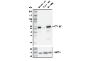 CYP17A1 (E6A7G) XP Rabbit mAb