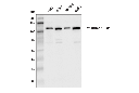 Exportin-1/CRM1 (D6V7N) Rabbit mAb