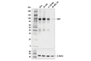 FAP (E1V9V) Rabbit mAb