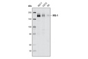 IRS-1 (D23G12) Rabbit mAb