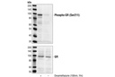 Phospho-Glucocorticoid Receptor (Ser211) Antibody