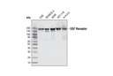 EGF Receptor (C74B9) Rabbit mAb