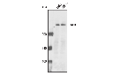 ATR Antibody