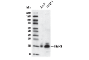TIMP3 (D74B10) Rabbit mAb