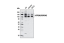 ATP2A2/SERCA2 (D51B11) Rabbit mAb