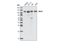 Axin1 (C76H11) Rabbit mAb