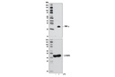 TNF-α (D1G2) Rabbit mAb (IF/Flow Preferred)