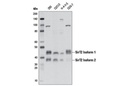 SirT2 (D4O5O) Rabbit mAb