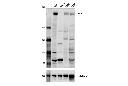 p300 (D1M7C) Rabbit mAb