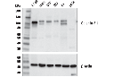 Catenin δ-1 (D7S2M) XP Rabbit mAb