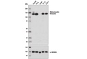 Vinculin (E1E9V) XP Rabbit mAb