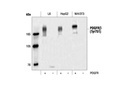 Phospho-PDGF Receptor β (Tyr751) Antibody