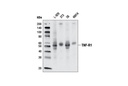 TNF-R1 (D3I7K) Rabbit mAb (Rodent Specific)
