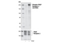Phospho-PDGF Receptor β (Tyr1009) (42F9) Rabbit mAb
