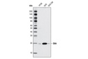 Shh (C9C5) Rabbit mAb