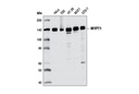 MYPT1 (D6C1) Rabbit mAb
