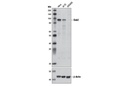 Dab2 (D7O9T) Rabbit mAb