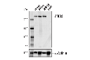 ARID2 (D8D8U) Rabbit mAb