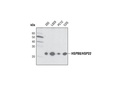 HSPB8/HSP22 Antibody