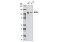 NEDD4 (D82F4) Rabbit mAb