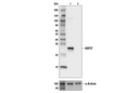 HSP27 (E1J4D) Rabbit mAb (IHC Preferred)