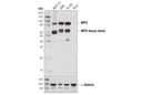Myeloperoxidase (E1E7I) XP Rabbit mAb
