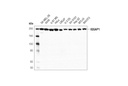 IQGAP1 (D8K4X) XP Rabbit mAb