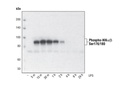 Phospho-IKKα/β (Ser176/180) (16A6) Rabbit mAb