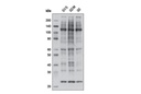 Phospho-CDK Substrate Motif [(K/H)pSP] MultiMab Rabbit mAb mix