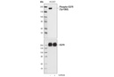 EGF Receptor (EGFR1) Mouse mAb (IP Specific)