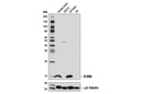 S100B (D10G6) Rabbit mAb