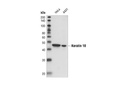 Keratin 18 (DC10) Mouse mAb