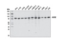 ACO2 (D6D9) XPRabbit mAb