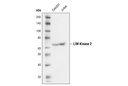 LIMK2 (8C11) Rabbit mAb