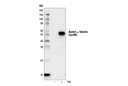 Acetyl-α-Tubulin (Lys40) (D20G3) XP Rabbit mAb (HRP Conjugate)