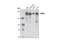 MSH6 (D60G2) XP Rabbit mAb