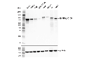 RHAMM/CD168 (E7S4Y) Rabbit mAb