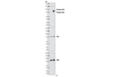 Phospho-IKKα/β (Ser176/180) Antibody Sampler Kit