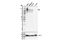 Mer (D8W8T) Rabbit mAb