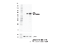 E-Tag (D1U2Q) Rabbit mAb