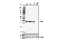 CD20 (E7B7T) XP Rabbit mAb