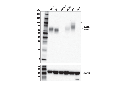 DNAM-1/CD226 (E8L9G) XP Rabbit mAb
