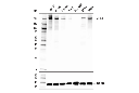 ZEB1 (E2G6Y) XP Rabbit mAb